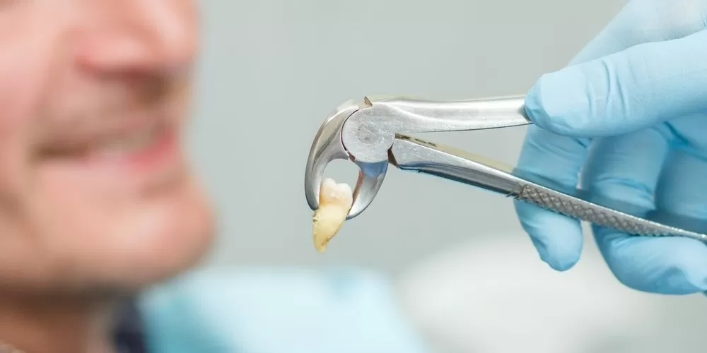 Çekim Sonrası Kanama ve Şişlik: Belirtiler, Nedenler ve Çözümler